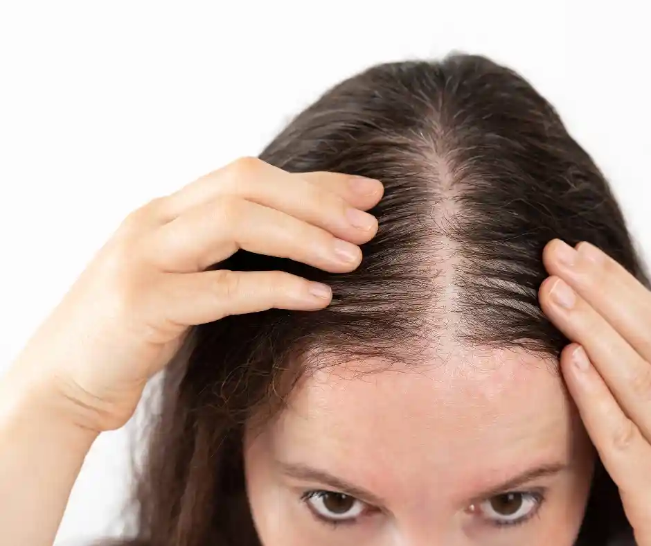 woman suffering from thinning hair and hairloss