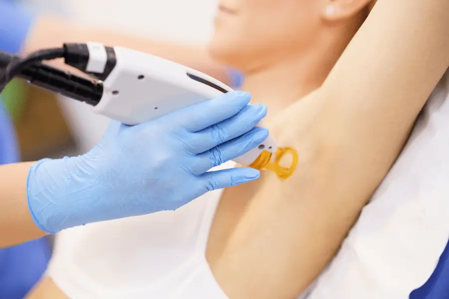 laser hair removal cost