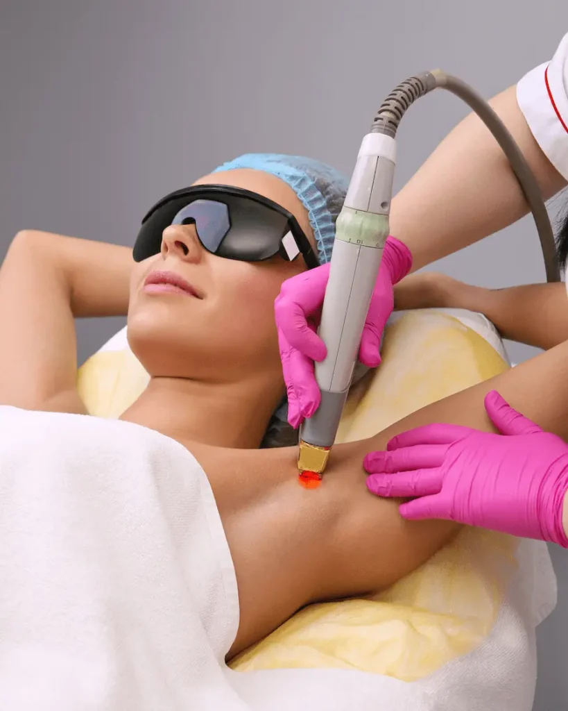 woman getting laser hair removal treatment underarms treatment with clarity II