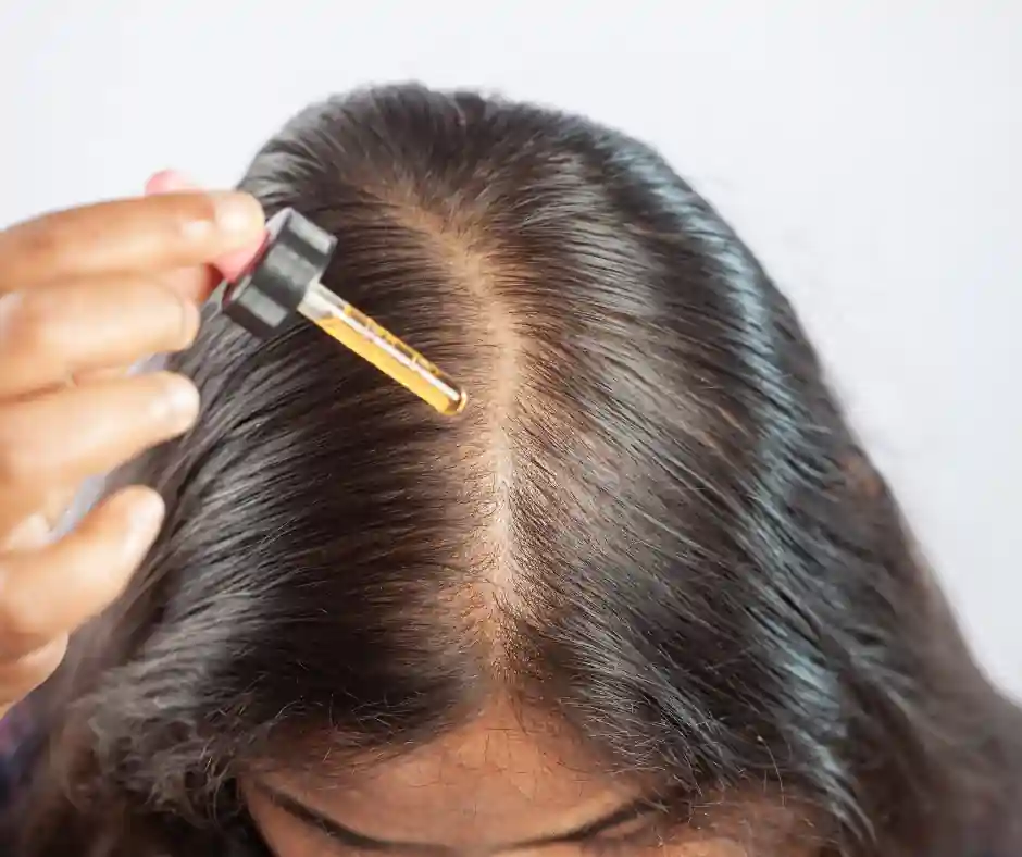 woman applying topical Minoxidil