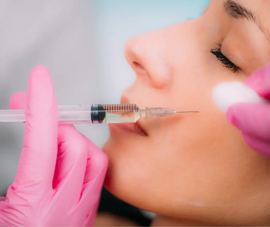 KARISMA RH Collagen Soft Filler injection applied to cheek area for skin rejuvenation