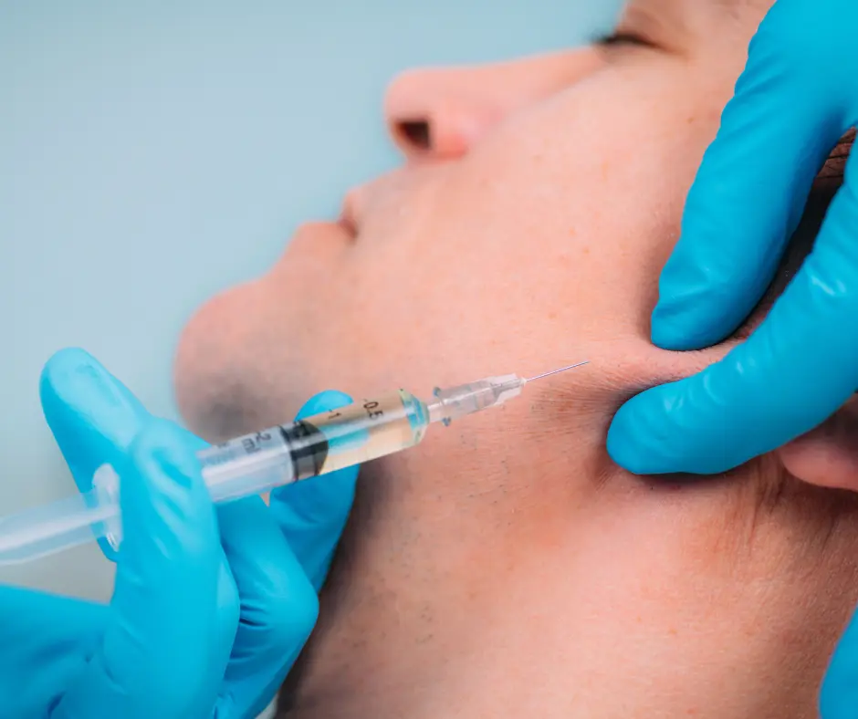 karisma rh collagen soft filler injection on jawline