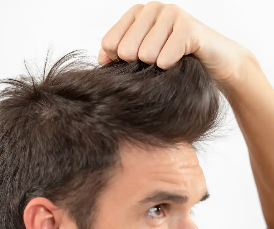 Healthy male hair - Alopecia Areata Treatment Options Available at Parpar
