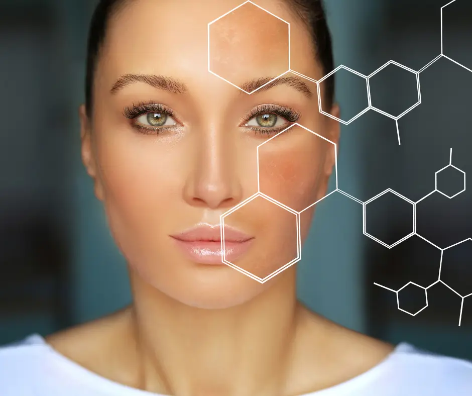 Melasma Treatment Airmont, NY
