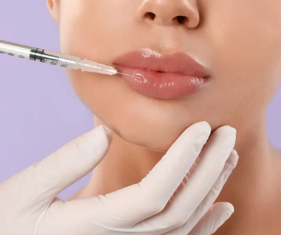 does filler dissolve - lip filler dissolver with hynidase