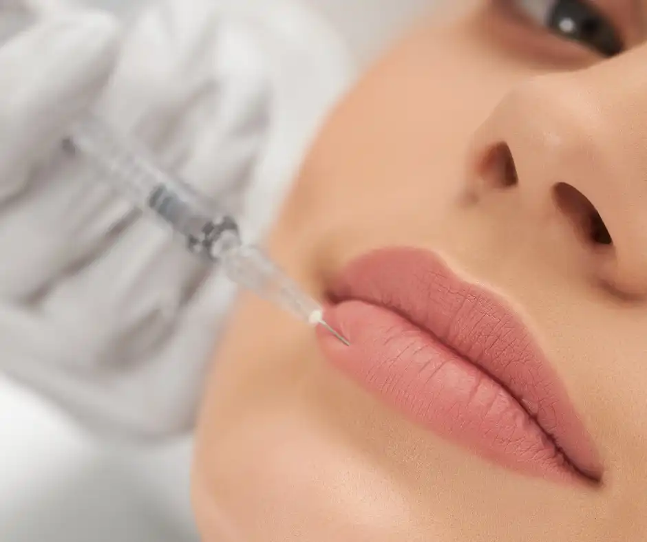 hyaluronic acid lip filler