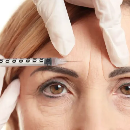 belotero soft fine line treatment filler injection