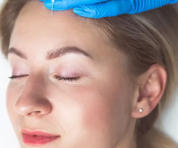 woman receiving filler woman receiving filler