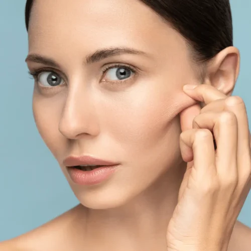 Smooth, youthful skin after Juvéderm Ultra 3 dermal filler treatment