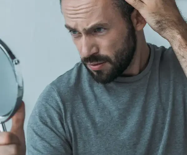 male pattern baldness