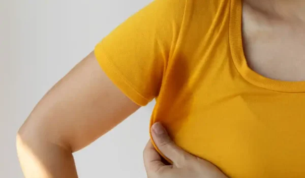 Hyperhidrosis sweaty underarm problem