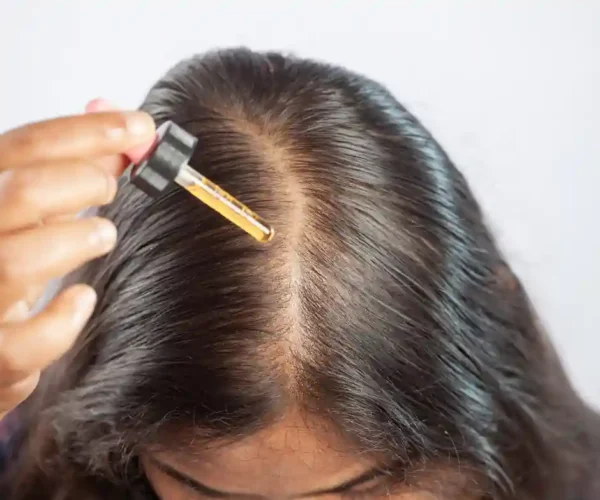 woman applying topical Minoxidil