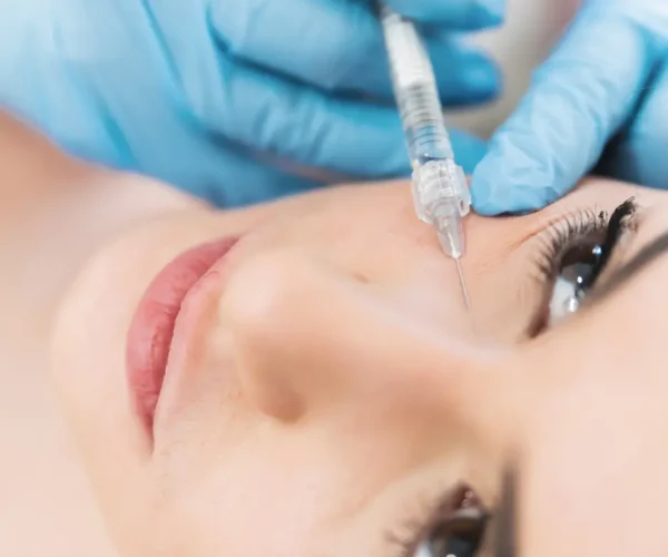 under eye filler